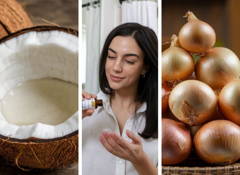 Onion and Coconut Oil Can Take You From Hair Loss to Hair Goals