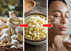 Garlic Beauty Remedies for Fresh, Smooth-Looking Skin