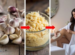 Simple Garlic DIY Treatments for Hair-Free-Looking Skin