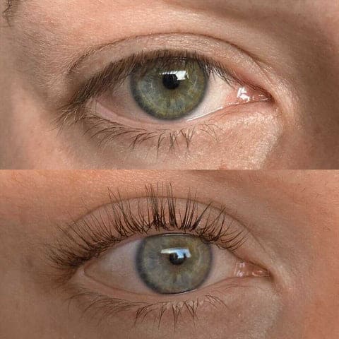 Eyelashes Problems