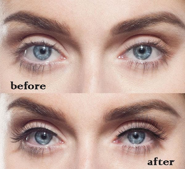 Eyelashes Problems