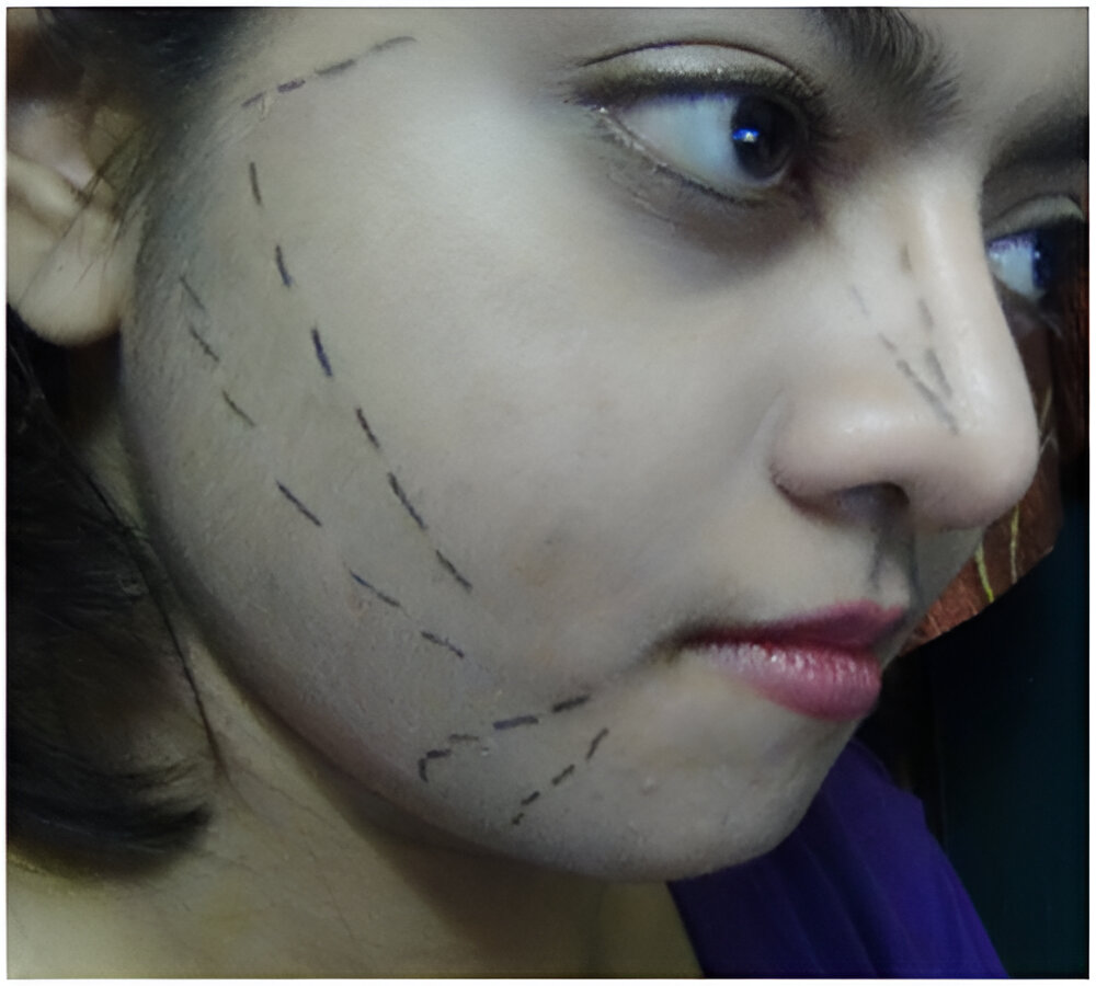 How to Apply Blush for Round Faces