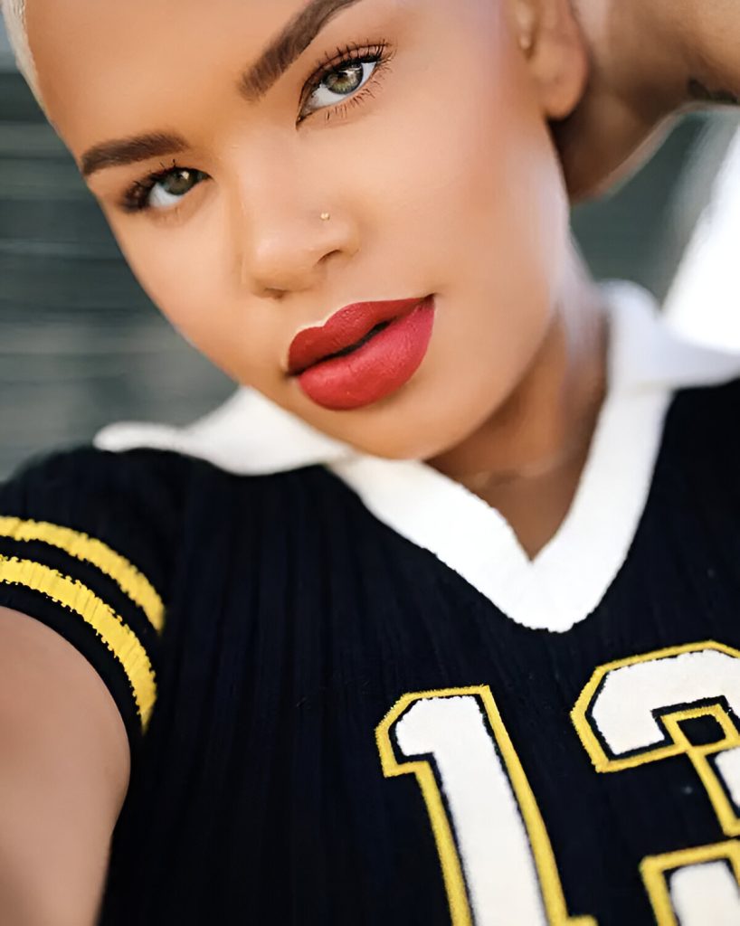 Overlarge Lip Shape