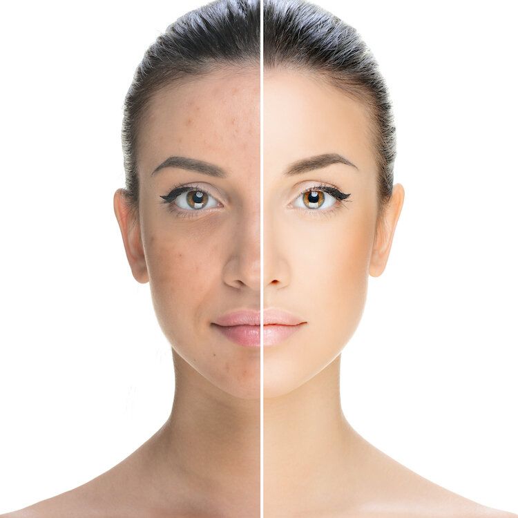 Why Does Your Face Tan Differently?