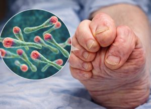 10 Alarming Signs of Tetanus and What They Mean for Your Health