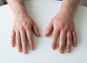 10 Hyperreflexia Symptoms You Shouldn't Ignore