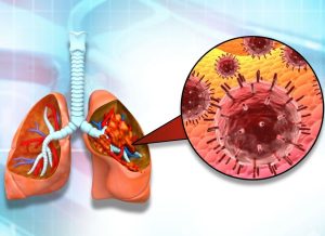 10 Key RSV Symptoms to Watch For in Adults