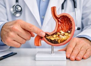 10 Warning Signs of Gastroparesis You Should Be Aware Of