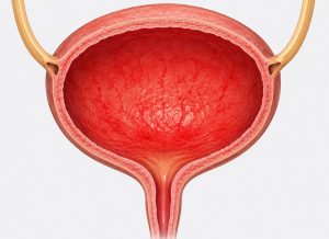 11 Common Symptoms of Acute Cystitis You Shouldn’t Ignore