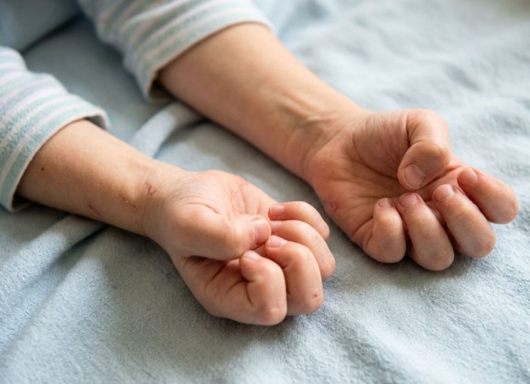 12 Key Signs of Seizures and How to Respond with Proper First Aid