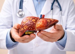12 Leading Causes of High Liver Enzymes and How to Address Them