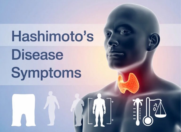 15 Hashimoto's Disease Symptoms That Affect Your Whole Body