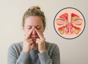 4 Symptoms of a Sinus Infection You Might Be Overlooking