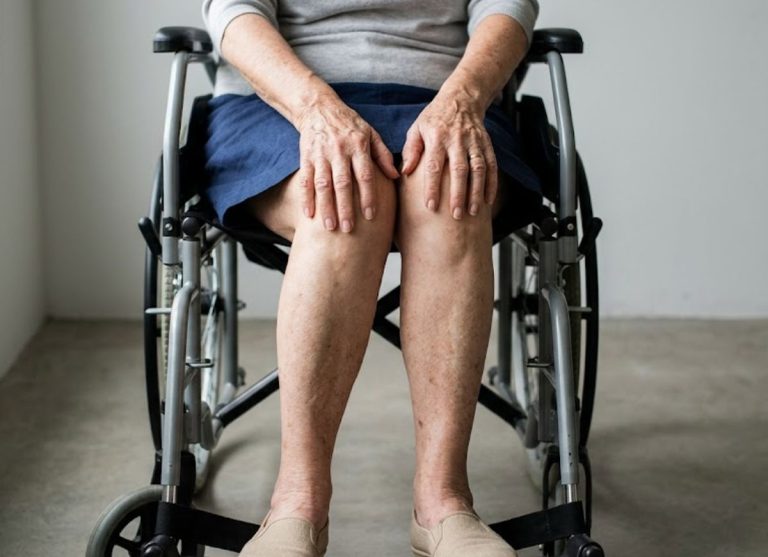 5 Warning Signs of Septic Arthritis You Shouldn't Ignore