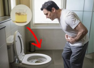 6 Signs Foamy Urine Could Indicate Kidney Problems