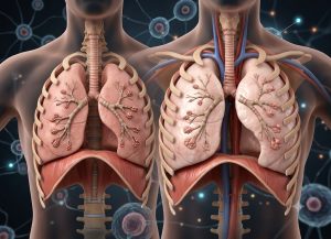 7 Causes of Hyperinflated Lungs and What They Mean