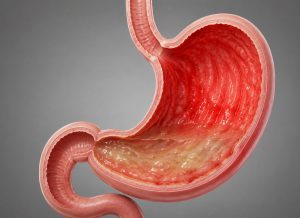 7 Common Indigestion Symptoms That Signal an Upset Stomach