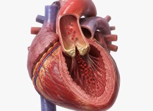 7 Key Warning Signs of Essential Thrombocythemia