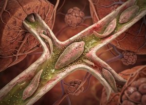 7 Signs of Liver Flukes and How They Can Affect the Bile Ducts