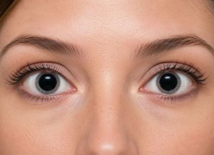 8 Common Causes of Dilated Pupils You Should Know