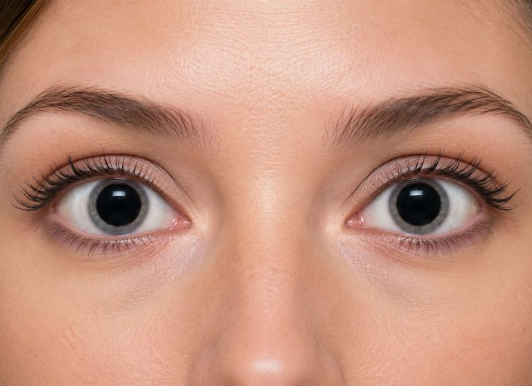 8 Common Causes of Dilated Pupils You Should Know