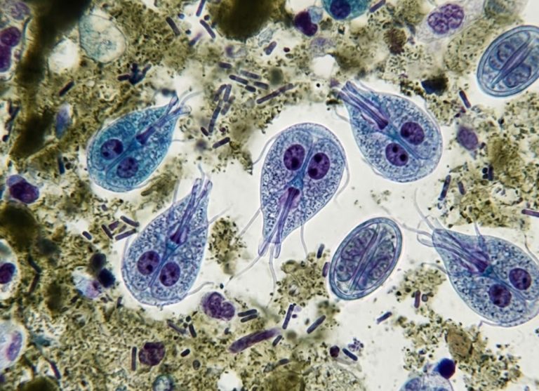 9 Symptoms of Giardia Infection You Might Be Overlooking