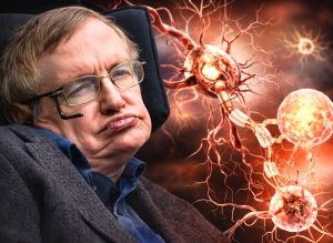 Amyotrophic Lateral Sclerosis (ALS): What It Is, Causes, Symptoms, and Treatment Options