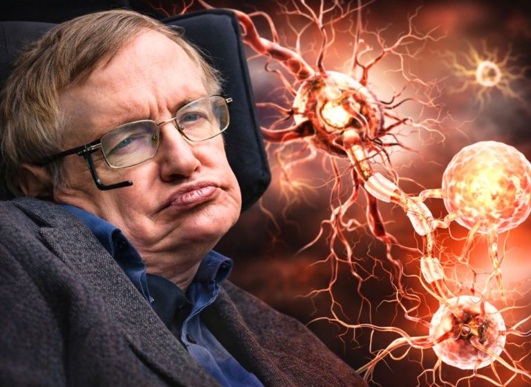 Amyotrophic Lateral Sclerosis (ALS): What It Is, Causes, Symptoms, and Treatment Options