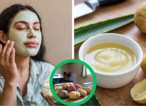 Potato Beauty Remedies for Soft, Smooth, Glowing Skin