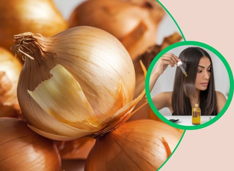 A Natural Remedy For Hair Growth Is Using Onion Peels Right In Your Kitchen
