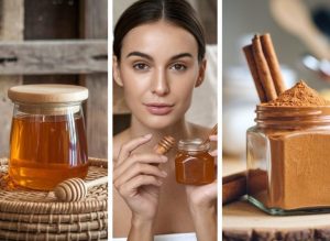 DIY Honey & Cinnamon Remedy for Blackhead-Prone Skin