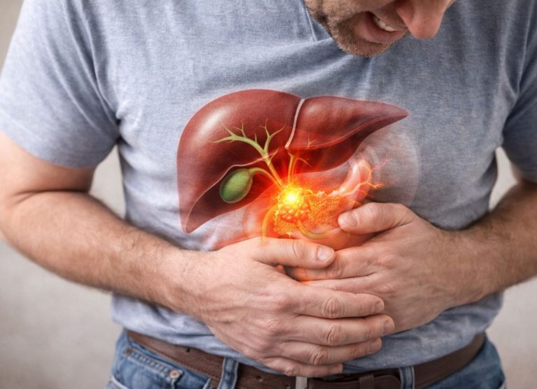 Biliary Colic: What It Is, Symptoms, Causes, and How to Manage It