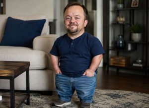 Dwarfism: Symptoms, Causes, Types, and Diagnosis Explained