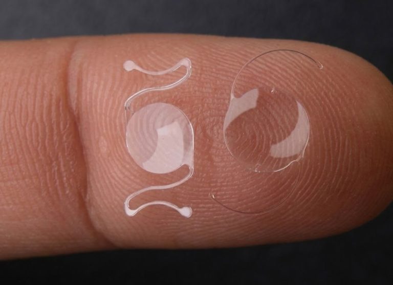 Eye Lens Replacement Surgery: Types of IOLs, Benefits, Risks, and Recovery
