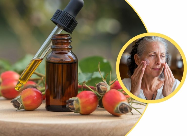 4 Natural Remedies to Remove Age Spots with Rosehip Oil for Absolute Radiant Skin
