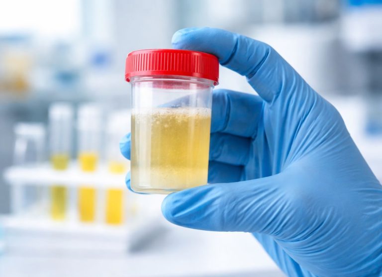 Why Is My Cloudy Urine? Common Causes & Effective Prevention