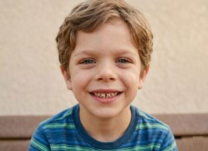 Williams Syndrome: Symptoms, Causes, and Effective Management Strategies