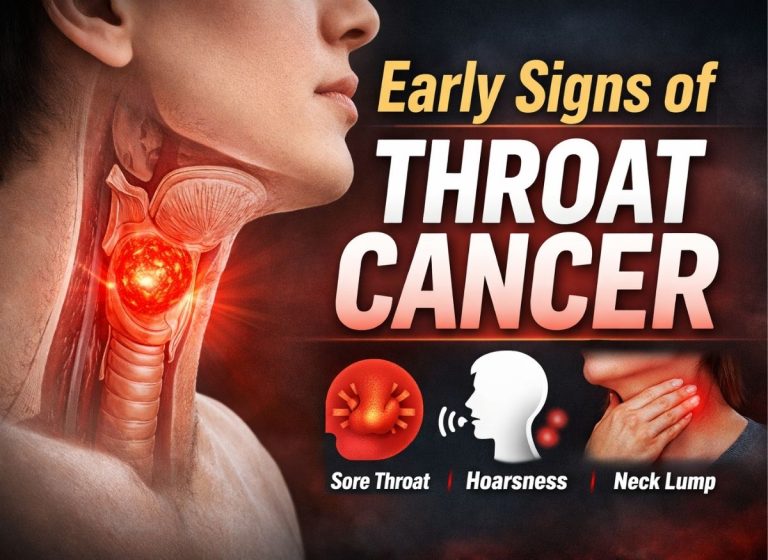 Know 7+ Early Signs of Throat Cancer Before It Spreads