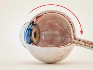 6+ Warning Signs of High Eye Pressure You Shouldn’t Ignore