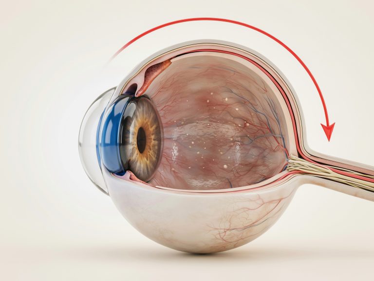 6+ Warning Signs of High Eye Pressure You Shouldn’t Ignore