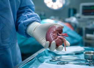 A Complete Guide to Kidney Transplant for Patients