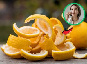 Glow Naturally The Skincare Benefits of Lemon Peels