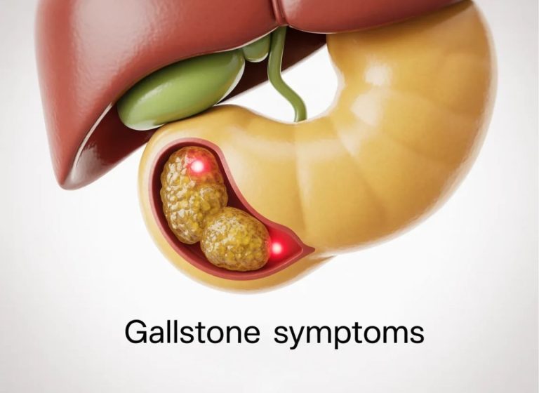 7 Warning Signs of Gallstones and When to Seek Medical Care