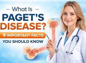 What Is Paget’s Disease? 9 Important Facts You Should Know