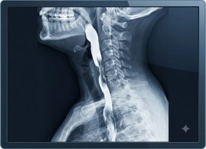 Esophagram vs Endoscopy: 6 Differences Patients Should Know